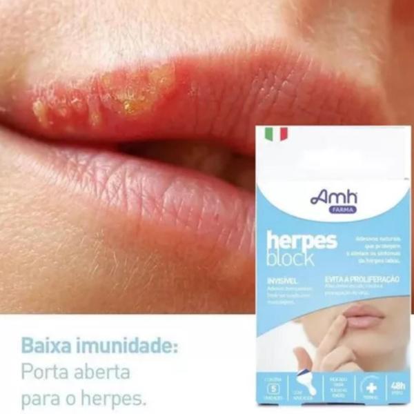 Imagem de Kit 5 Adesivo Herpes Block Labial Proteção Dermatológico