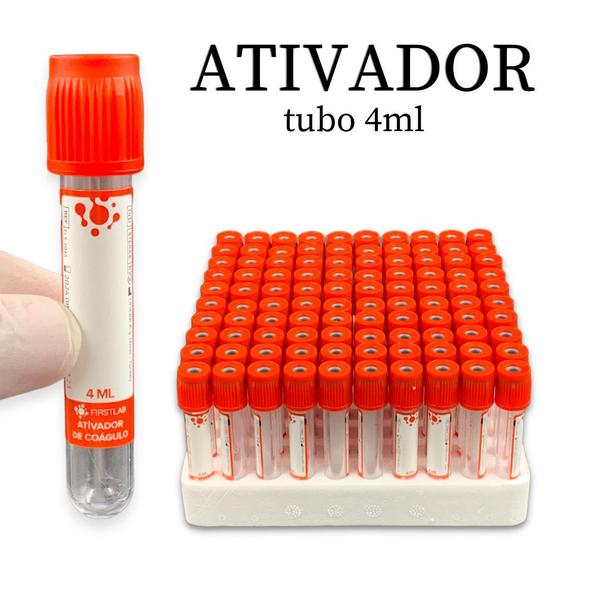 Imagem de Kit Com 200 Tubos Tampa Vermelha + Ativador 150 Mini Tubos Edta K2