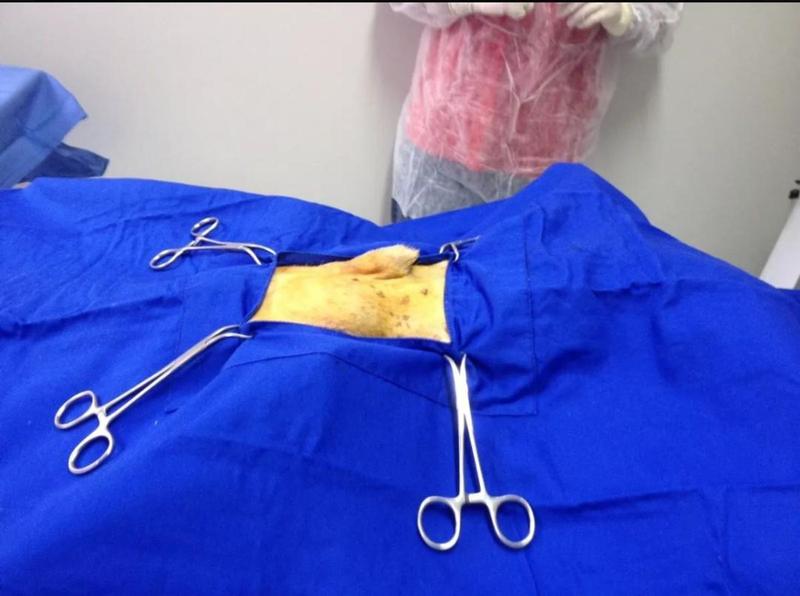Imagem de Kit De Cirurgia Veterinária Campos Cirúrgicos & Capotes Cirúrgicos / Aventais Cirurgico
