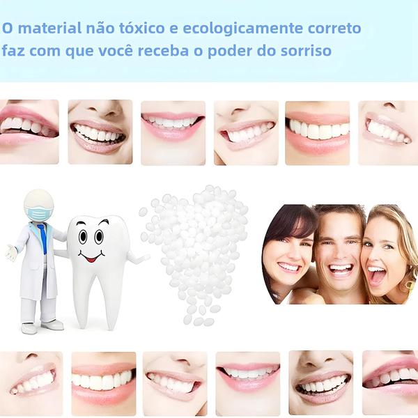 Imagem de Kit de Reparo de Dentes Quebrados - 10g de Contas Térmicas e Adesivo