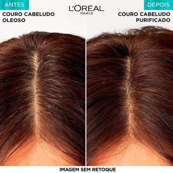 Imagem de Kit Elseve Pure Hialurônico Loréal Paris Sh + Cond 200ml