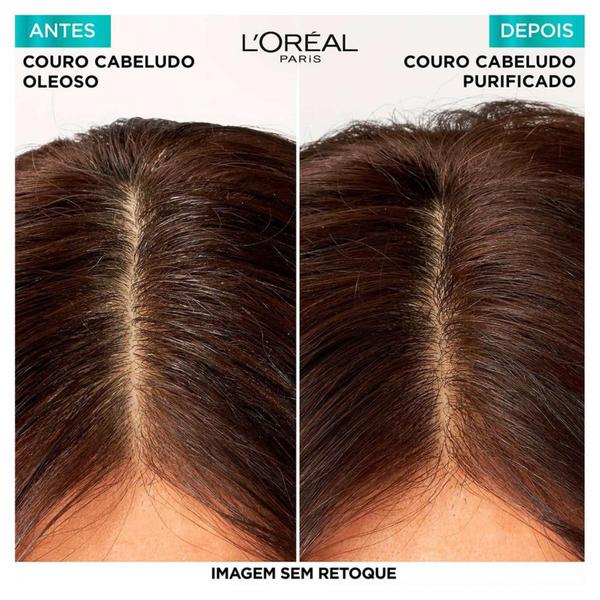 Imagem de Kit Elseve Pure Hialurônico Shampoo Micelar Antioleosidade