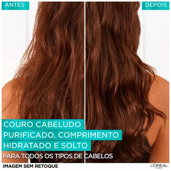 Imagem de Kit Elseve Pure Hialurônico Shampoo Micelar Antioleosidade