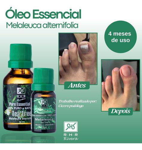 Imagem de Kit Melaleuca Puro 10ml + Melaleuca Pronto Para Pele 30ml