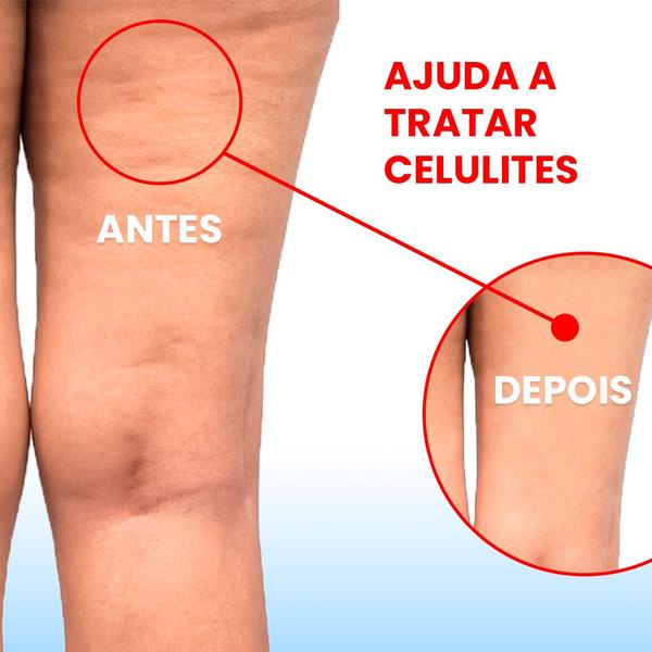 Imagem de Kit Mini Massageador Alivio Dores Massoterapia Carrinho Top