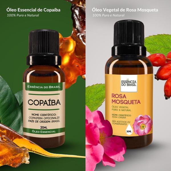 Imagem de Kit Óleo Essencial Copaíba 20Ml + Vegetal Rosa Mosqueta 30Ml