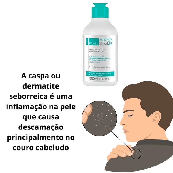 Imagem de Kit Panta Anticaspa 3 Em 1 - Shampoo, Condicionador E Anticaspa - 3 Unidades