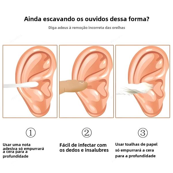 Imagem de Kit Removedor de Cera de Ouvido - Espiral, Colher e Cureta para Limpeza Fácil