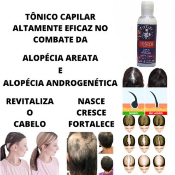 Imagem de Kit Tônico + Suplemento Para Cabelo Pele e Unhas 60 Cápsulas