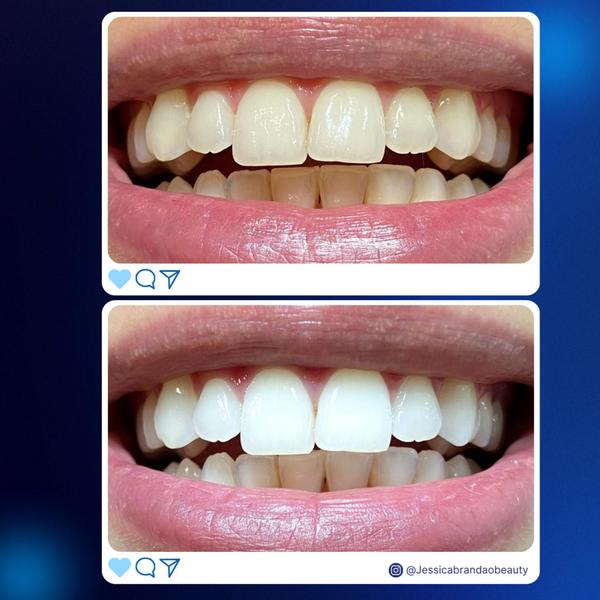 Imagem de Lavi white gel dental