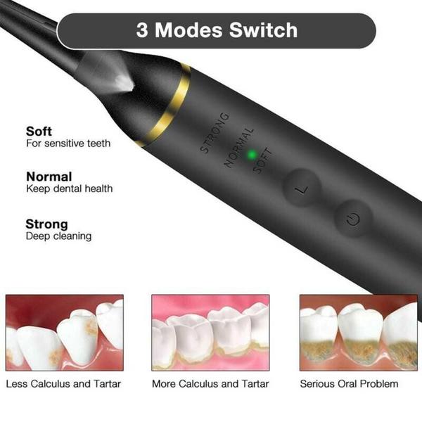 Imagem de Limpador de dentes elétrico Wokex Ultrasonic Dental Calculus Remo