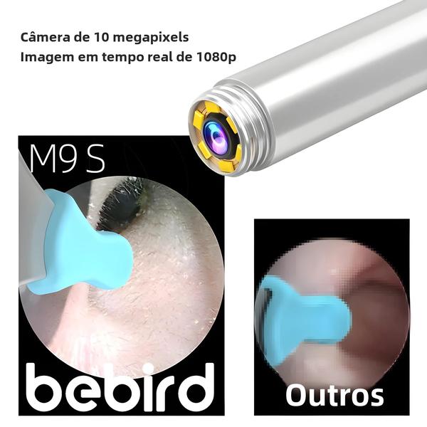 Limpador Visual de Ouvido Bebird M9 HD - Endoscópio e Kit de Remoção de Cerume Imagem de Limpador Visual de Ouvido Bebird M9 HD - Endoscópio e Kit de Remoção de Cerume