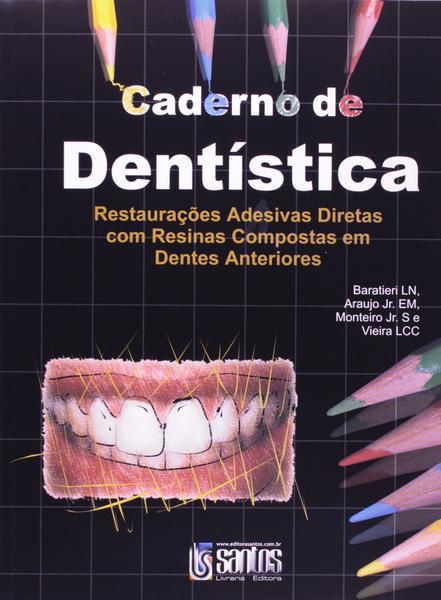 Imagem de Livro - Caderno de Dentística - Restaurações Adesivas Diretas em Res.