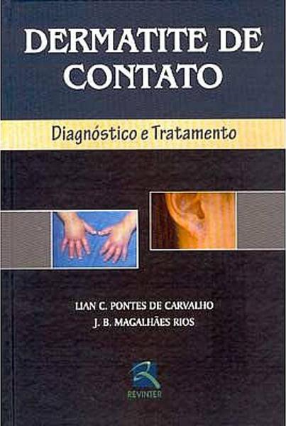 Imagem de Livro - Dermatite de Contato