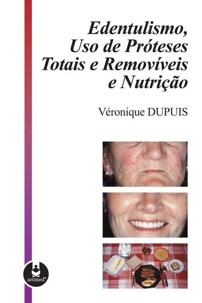 Imagem de Livro - Edentulismo, Uso de Próteses Totais e Removíveis e Nutrição