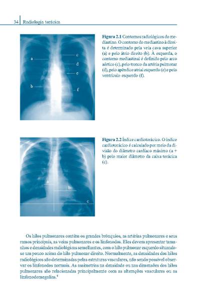 Imagem de Livro - Pneumologia