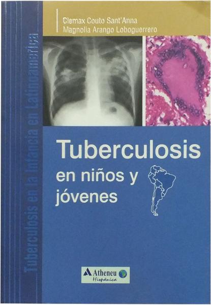 Imagem de Livro - Tuberculosis en niños y jóvenes