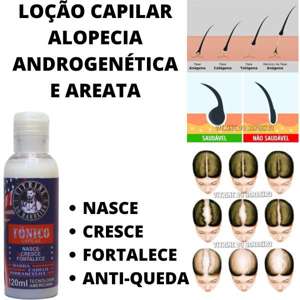 Imagem de Loção Capilar + Derma Roller De 0.50mm  P/ Uso Profissional!