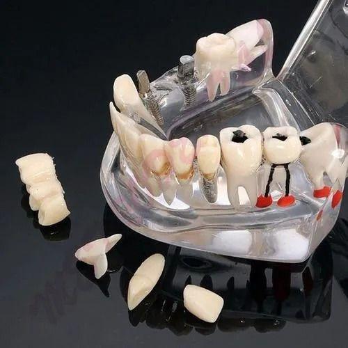 Imagem de Manequim Modelo Molde Dentário Odonto Boca Transparente