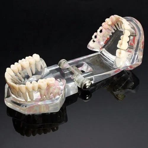 Imagem de Manequim Modelo Molde Dentário Odonto Boca Transparente