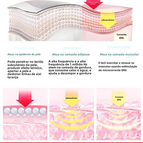 Imagem de Massageador 3 em 1: Cavitação Ultrassônica, EMS e Infravermelho para Emagrecimento