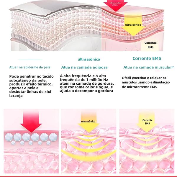 Imagem de Massageador 3 em 1: Cavitação Ultrassônica, EMS e Infravermelho para Emagrecimento