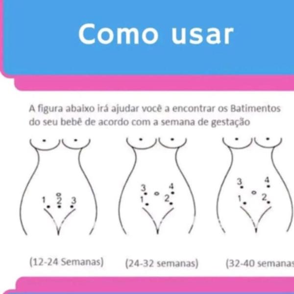 Imagem de Monitor Fetal Batimentos Ultrassom Bebe Gestante Cor Rosa