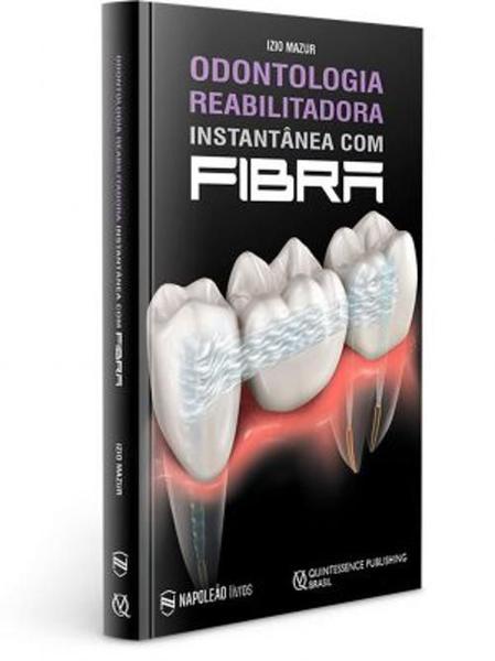 Imagem de Odontologia Reabilitadora Instantânea com Fibra - NAPOLEAO