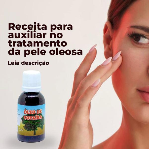 Imagem de Óleo Natural De Copaíba Puro - Aroeira Cosmética - 30mL - 100% vegetal, natural e vegano