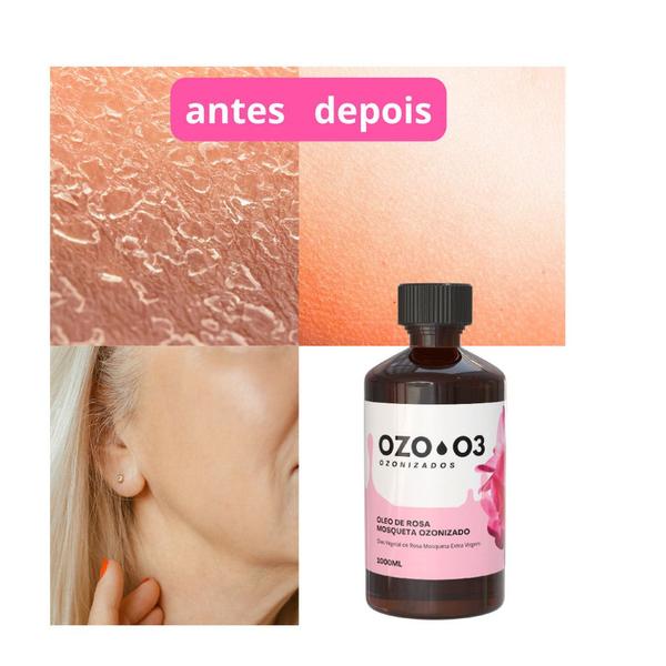 Óleo Rosa Mosqueta Ozonizado C Ozônio 1l Forte Anti Rugas - Ozo3 Imagem de Óleo Rosa Mosqueta Ozonizado C Ozônio 1l Forte Anti Rugas