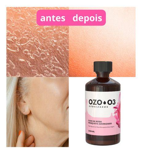 Óleo Rosa Mosqueta Ozonizado C Ozônio 1l Forte Anti Rugas - Ozo3 Imagem de Óleo Rosa Mosqueta Ozonizado C Ozônio 1l Forte Anti Rugas