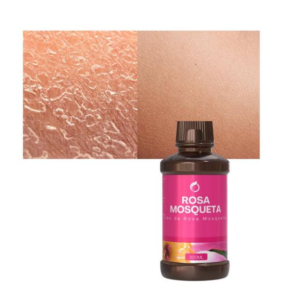 Óleo Rosa Mosqueta Puro Natural 300ml Clareador De Virilha - Pura Óleos Imagem de Óleo Rosa Mosqueta Puro Natural 300ml Clareador De Virilha