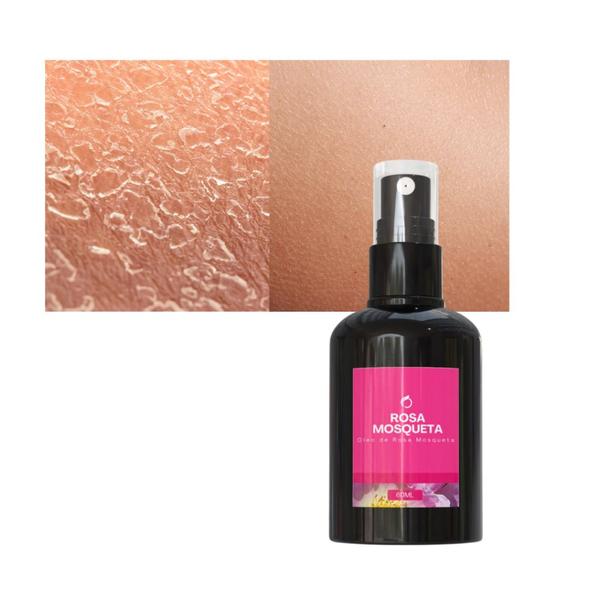 Óleo Rosa Mosqueta Puro Natural 60ml Clareador De Virilha - Pura Óleos Imagem de Óleo Rosa Mosqueta Puro Natural 60ml Clareador De Virilha
