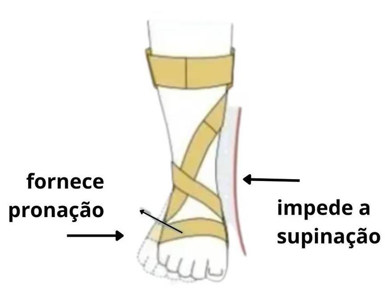 Imagem de Ortese Para Pé Caido Anti Equino Afo Dyna