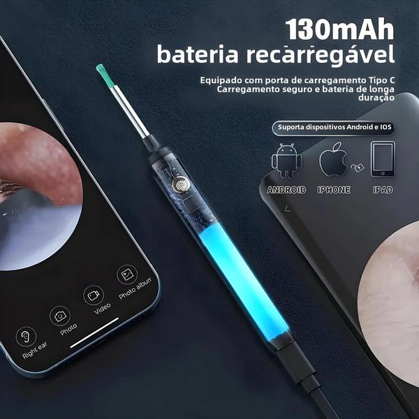 Imagem de Otoscópio Inteligente 1296p com Câmera Mini USB-C - Removedor de Cera de Ouvido