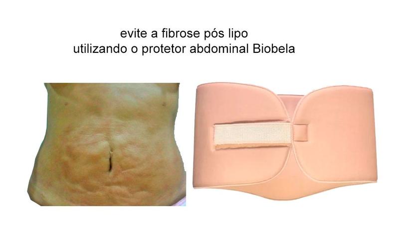 Imagem de Placa Abdominal Pós Cirurgica Faixa Ajust. Biobela Cod.1617c