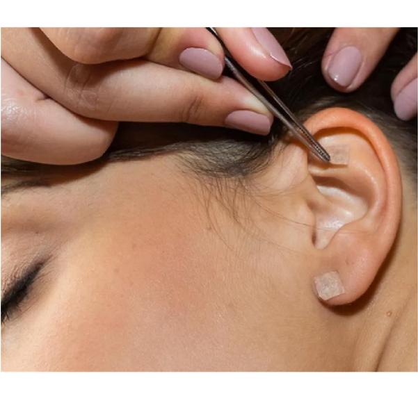 Ponto Auriculoterapia Inox Auricular C/ Micropore Caixa 30 cartelas - GoldLife - GL Imagem de Ponto Auriculoterapia Inox Auricular C/ Micropore Caixa 30 cartelas