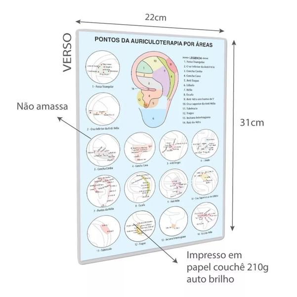 Ponto Auriculoterapia Inox Auricular C/ Micropore Caixa 30 cartelas - GoldLife - GL Imagem de Ponto Auriculoterapia Inox Auricular C/ Micropore Caixa 30 cartelas