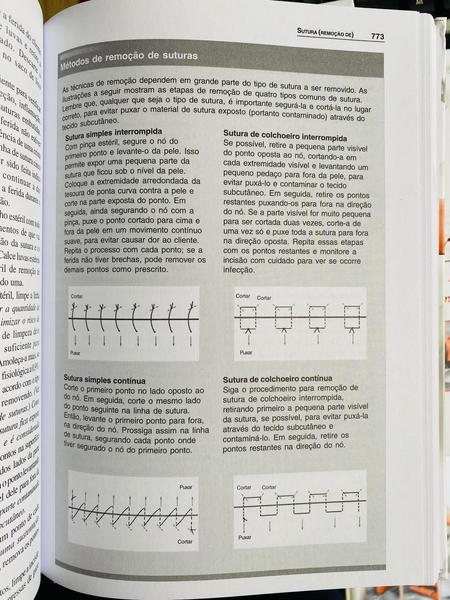 Imagem de Procedimentos Em Enfermagem - 3 Volumes Coleção Completa