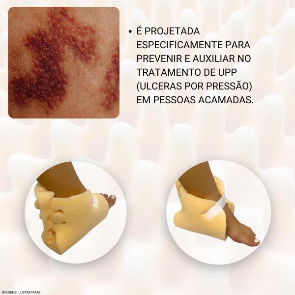 Imagem de Protetor Calcanhar Antiescara Espuma Acamados Pós Operatório