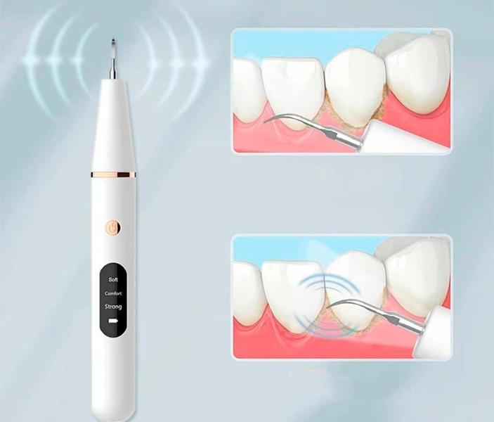 Imagem de Raspador De Tártaro Cálculo Dental Elétrico Removedor Luz