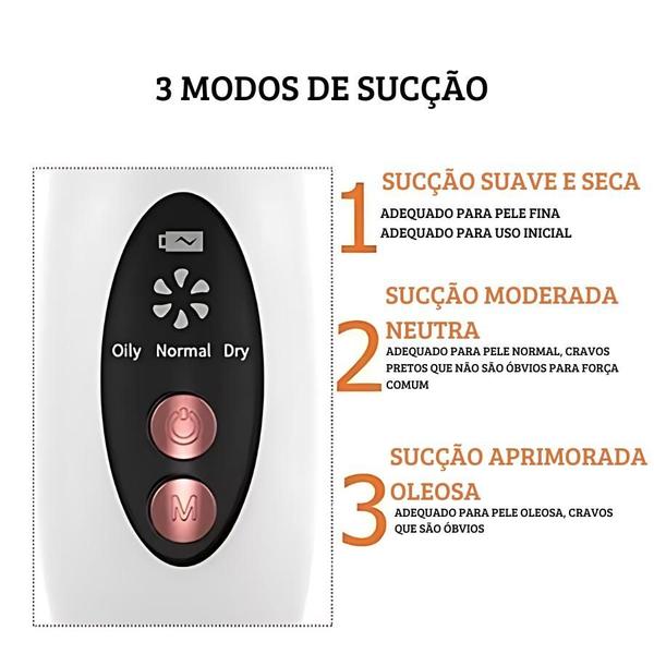 Imagem de Removedor de Cravos com Sucção Ajustável e Recarregável