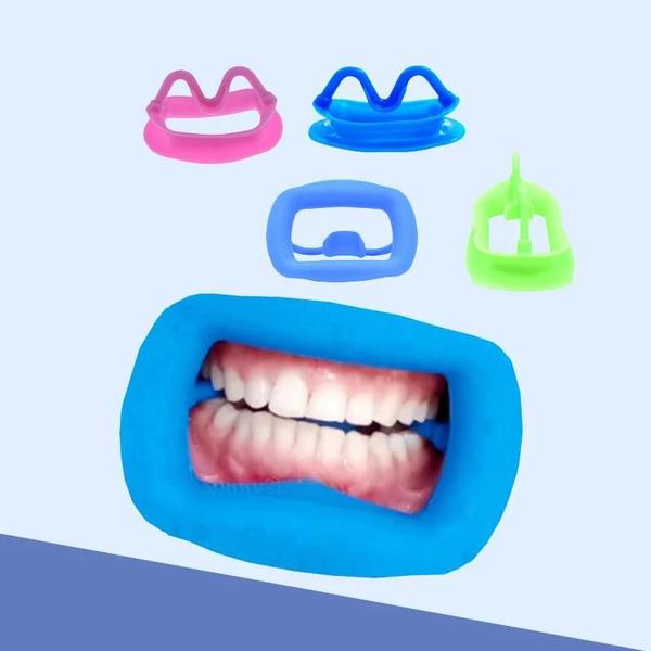 Imagem de Retrator de Lábios e Bochechas de Silicone Macio 3D - Ferramenta Ortodôntica Dental