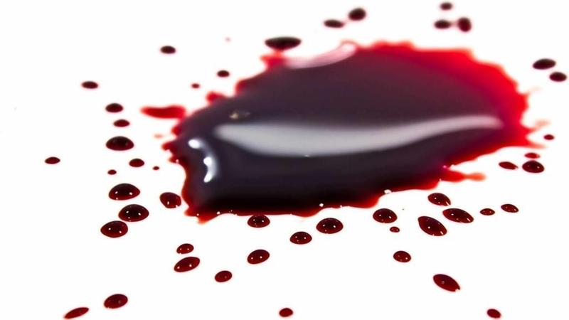 Imagem de Sangue Cenográfico Líquido Encenação Paixao De Cristo- 500Ml