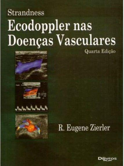 Imagem de Strandness ecodoppler nas doencas vasculares