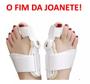 Imagem de 1 Par Kit Corretor Corretivo Para Joanetes Ortopédico Articulado tiras autocolantes