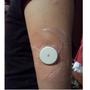 Imagem de 20 Adesivo Protetor De Libre Glicose Sensor + 20 Lenço Swabs
