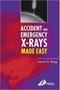 Imagem de Accident and emgerency x-rays made easy - CHURCHILL LIVINGSTONE, INC.