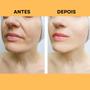 Imagem de Ácido Glicólico 10% Hidratante Facial Niacinamida Anti Acne Clareador Rejuvenescedor Creamy Skincare 30g