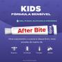 Imagem de After Bite Kids Pomada Para Picadas De Insetos 20g Importado